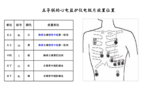 心电监护5个电极位置图,电极片放置位置在哪?-上海聚慕医疗器械有限公司