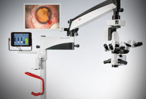 moller目乐眼科手术显微镜的功能-上海聚慕医疗器械有限公司