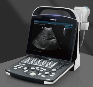 全数字便携式超声诊断系统