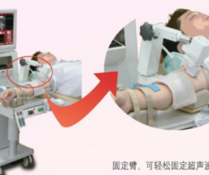 血管内皮功能测试仪-上海聚慕医疗器械有限公司